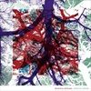 Widows-Weeds-70-CD